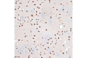 Immunohistochemistry of paraffin-embedded mouse brain using RBM3 antibody  at dilution of 1:100 (40x lens). (RBM3 antibody  (AA 1-157))