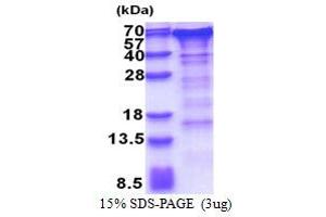 SDS-PAGE (SDS) image for Golgi Membrane Protein 1 (GOLM1) (AA 36-401) protein (His tag) (ABIN5853373) (GOLM1 Protein (AA 36-401) (His tag))