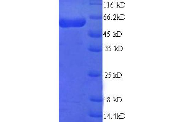 MINPP1 Protein (AA 31-487) (GST tag)