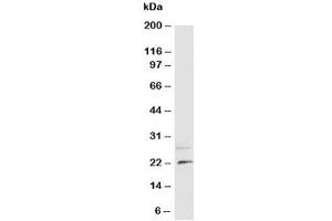 Western blot testing of NGF antibody and rat brain tissue lysate (Nerve Growth Factor antibody  (N-Term))