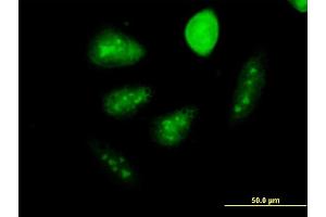 Immunofluorescence of monoclonal antibody to GCM1 on HeLa cell. (GCM1 antibody  (AA 108-166))