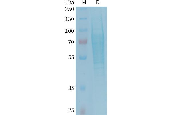 TREML2 Protein (AA 19-268) (His tag)