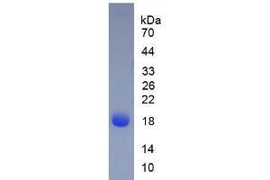 Image no. 1 for Beta Lactoglobulin (LGB) protein (ABIN5665391) (Beta Lactoglobulin (LGB) Protein)