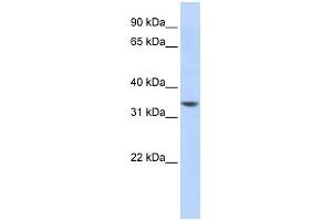 WB Suggested Anti-RP11-50D16. (NHLRC3 antibody  (Middle Region))