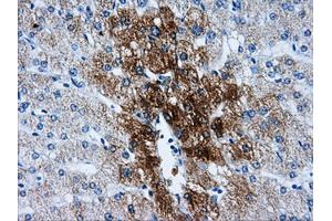 Immunohistochemical staining of paraffin-embedded liver tissue using anti-HSD17B10mouse monoclonal antibody. (HSD17B10 antibody)