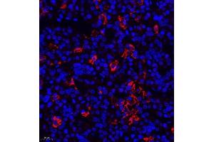 Immunofluorescence of paraffin embedded rat hypophysis using TSH (ABIN7075906) at dilution of 1:400 (400x lens) (TSHB antibody)