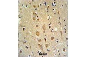 Immunohistochemistry (IHC) image for anti-Apoptosis-Inducing, TAF9-Like Domain 1 (APITD1) antibody (ABIN3002170) (APITD1 antibody)