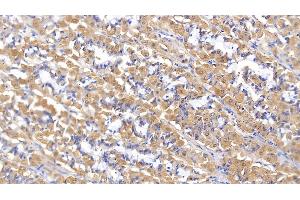 Detection of MMP2 in Human Stomach Tissue using Polyclonal Antibody to Matrix Metalloproteinase 2 (MMP2) (MMP2 antibody  (AA 445-662))