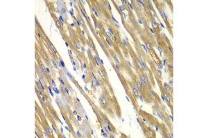 Immunohistochemistry of paraffin-embedded rat heart using TYR antibody. (TYR antibody)