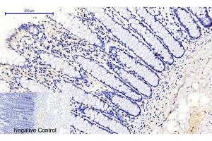 Immunohistochemical analysis of paraffin-embedded human colon tissue. (JAK1 antibody  (pTyr1022))