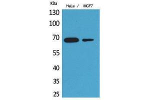 Western Blotting (WB) image for anti-phosphoenolpyruvate Carboxykinase 1 (Soluble) (PCK1) (Internal Region) antibody (ABIN3187769) (PCK1 antibody  (Internal Region))