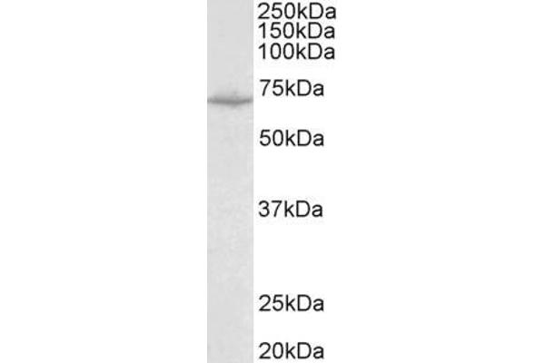 SLC6A8 antibody  (Internal Region)