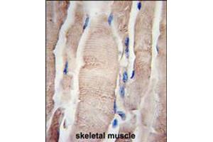 Formalin-fixed and paraffin-embedded human skeletal muscle tissue reacted with PHPT1 Antibody , which was peroxidase-conjugated to the secondary antibody, followed by DAB staining. (PHPT1 antibody  (C-Term))