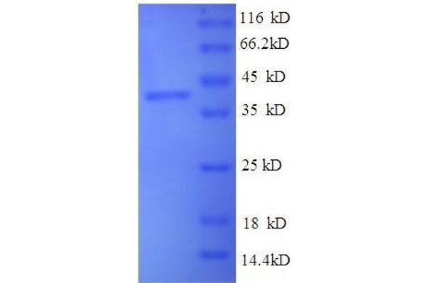 BDNF Protein (AA 137-237, partial) (GST tag)