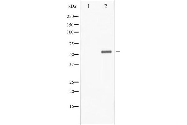 CHEK1 antibody  (pSer301)