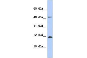 WB Suggested Anti-SFRS12IP1 Antibody Titration: 0. (SFRS12IP1 antibody  (Middle Region))
