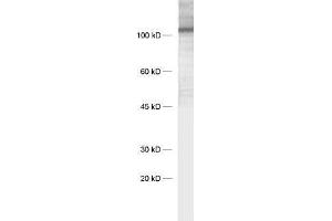 dilution: 1 : 1000, sample: synaptic membrane fraction of rat brain (LP1) (LRFN3 antibody)