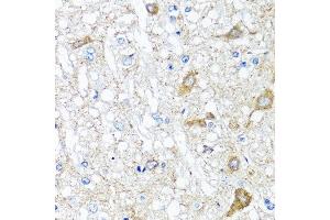 Immunohistochemistry of paraffin-embedded rat brain using SERPINA7 antibody at dilution of 1:100 (40x lens). (SERPINA7 antibody)