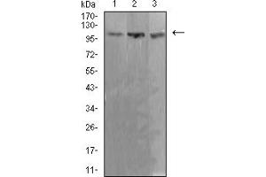 Western blot analysis using ADAR mouse mAb against Ramos (1), K562 (2), and Jurkat (3) cell lysate. (ADAR antibody  (AA 1085-1223))
