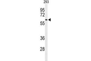 Western Blotting (WB) image for anti-Sorting Nexin 27 (SNX27) antibody (ABIN3004388) (SNX27 antibody)