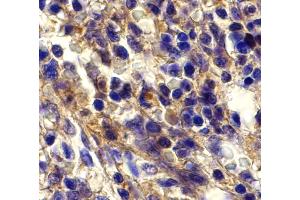 Immunohistochemistry (IHC) image for anti-Chemokine (C-X-C Motif) Receptor 6 (CXCR6) (N-Term) antibody (ABIN1031691) (CXCR6 antibody  (N-Term))