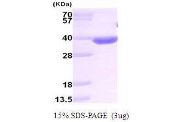 AKR1B10 Protein (AA 1-316)