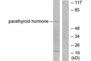 Western Blotting (WB) image for anti-Parathyroid Hormone (PTH) (AA 51-100) antibody (ABIN2889245) (PTH antibody  (AA 51-100))