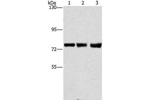 Western Blot analysis of MCF7, hela and 293T cell using GGCX Polyclonal Antibody at dilution of 1:400 (GGCX antibody)