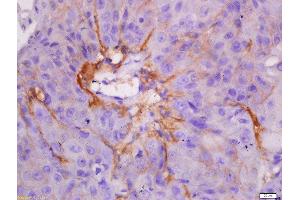 Immunohistochemistry (Paraffin-embedded Sections) (IHC (p)) image for anti-Keratin 7 (KRT7) (AA 251-350) antibody (ABIN732023)