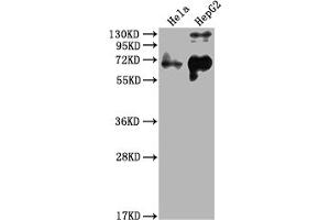 Western Blot Positive WB detected in: Hela whole cell lysate, HepG2 whole cell lysate All lanes: YAP1 antibody at 1:2000 Secondary Goat polyclonal to rabbit IgG at 1/50000 dilution Predicted band size: 55, 53, 49, 37, 49, 50, 51, 54 kDa Observed band size: 65 kDa (YAP1 antibody  (AA 155-504))