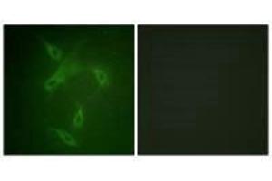 Immunofluorescence analysis of NIH/3T3 cells, using JAK2 (Ab-570) antibody. (JAK2 antibody  (Tyr570))