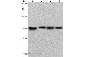 Western blot analysis of HepG2 and 293T cell, human kidney cancer tissue and K562 cell, using F11R Polyclonal Antibody at dilution of 1:500 (F11R antibody)