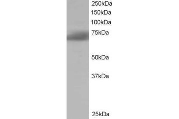 SH3BP1抗体（C-Term）