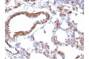 Formalin-fixed, paraffin-embedded rat lung stained with pan Muscle Actin antibody (Pan Muscle Actin antibody)