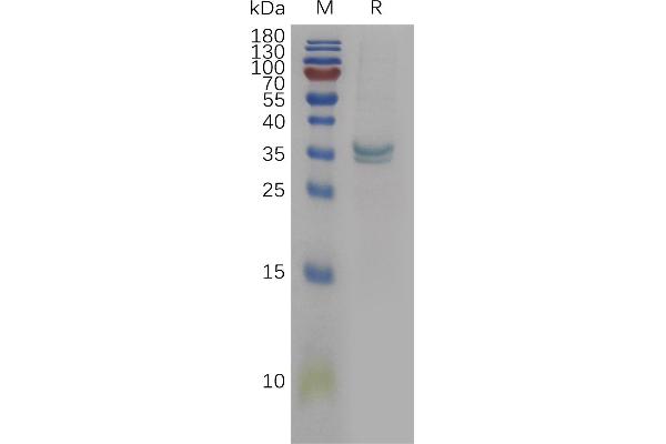 PPT1 Protein (AA 28-306) (His tag)