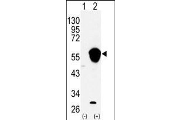 ALDH3A1 antibody  (N-Term)