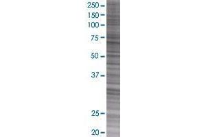 LOC26010 transfected lysate. (DNAPTP6 293T Cell Transient Overexpression Lysate(Denatured))