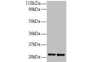 Western blot All lanes: RPS9 antibody at 2 μg/mL Lane 1: 293T whole cell lysate Lane 2: EC109 whole cell lysate Secondary Goat polyclonal to rabbit IgG at 1/15000 dilution Predicted band size: 21 kDa Observed band size: 21 kDa (RPS9 antibody  (AA 2-184))