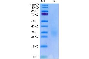 Biotinylated Human NKG2C&CD94 on Tris-Bis PAGE under reduced condition. (NKG2C & CD94 (AA 98-231) protein (His-Avi Tag,Biotin))