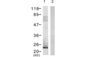 Western blot analysis of extract from 293 cells transfected with (lane 1) or without (lane 2) DYKDDDDK-tagged Bad using DYKDDDDK-Tag monoclonal Antibody (E1T508). (DYKDDDDK Tag antibody)