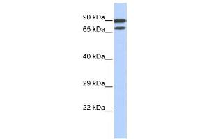 Western Blotting (WB) image for anti-Zinc Finger Protein 583 (ZNF583) antibody (ABIN2458219) (ZNF583 antibody)