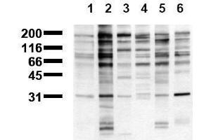 Western Blotting (WB) image for anti-Phosphotyrosine (phosphorylated) antibody (ABIN126874) (Phosphotyrosine antibody  (phosphorylated))