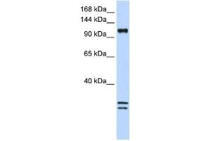 Western Blot showing NCKAP1L antibody used at a concentration of 1-2 ug/ml to detect its target protein. (NCKAP1L antibody  (C-Term))