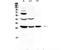 Western blot analysis of TL1A using anti-TL1A antibody . (TNFSF15 antibody  (AA 72-244))