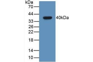 Detection of Recombinant GHRH, Human using Monoclonal Antibody to Growth Hormone Releasing Hormone (GHRH) (GHRH antibody  (AA 19-108))