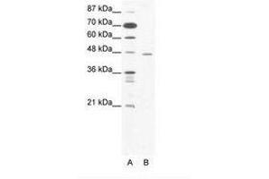 Image no. 1 for anti-C-terminal Binding Protein 1 (CTBP1) (C-Term) antibody (ABIN307428) (CTBP1 antibody  (C-Term))