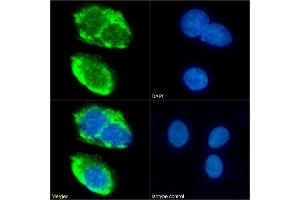Immunofluorescence staining of fixed HepG2 cells with anti-CD36 antibody 185-1G2 (B467). (Recombinant CD36 antibody)
