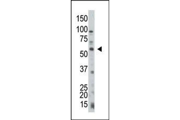 PTEN antibody  (C-Term)