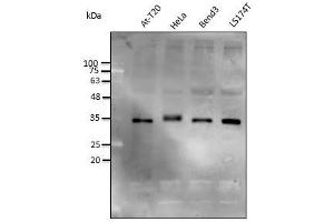 Anti-STUB1 Ab at 1/2,500 dilution, lysates at 50 µg per Iane, rabbit polyclonal to goat lgG (HRP) at 1/10,000 dilution, (STUB1 antibody)