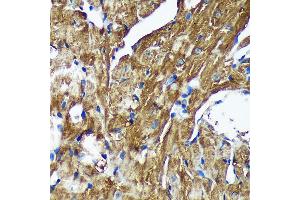 Immunohistochemistry of paraffin-embedded Mouse heart using [KO Validated] NSDHL Rabbit pAb (ABIN7268794) at dilution of 1:100 (40x lens). (NSDHL antibody  (AA 1-240))